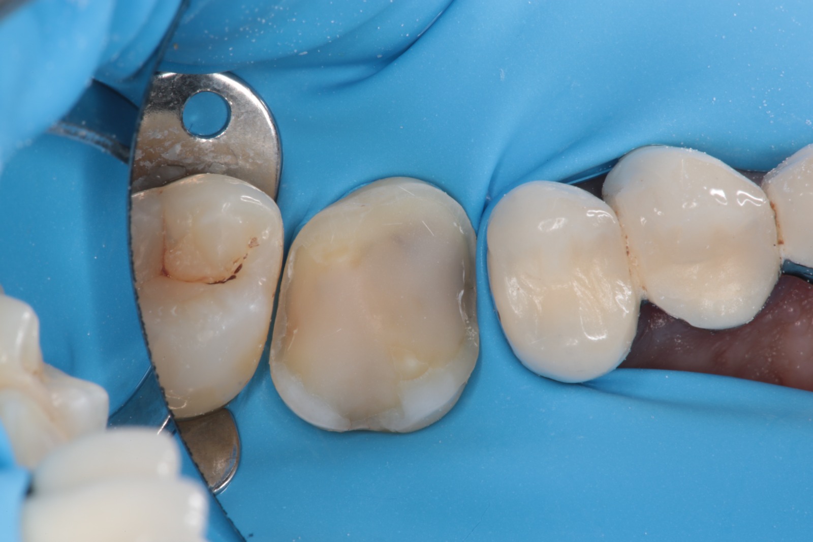 Overlay 16 avant restauration